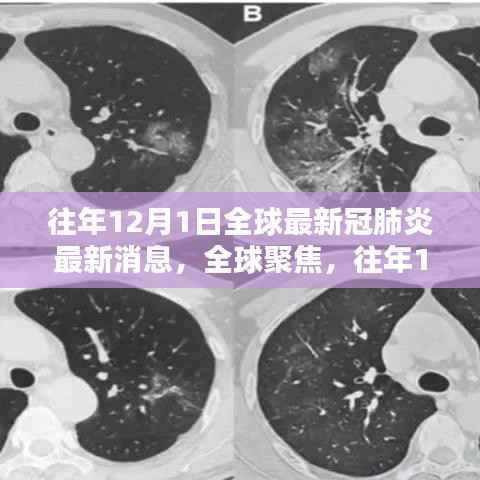 全球聚焦,往年12月1日新冠肺炎最新消息综述与观点阐述